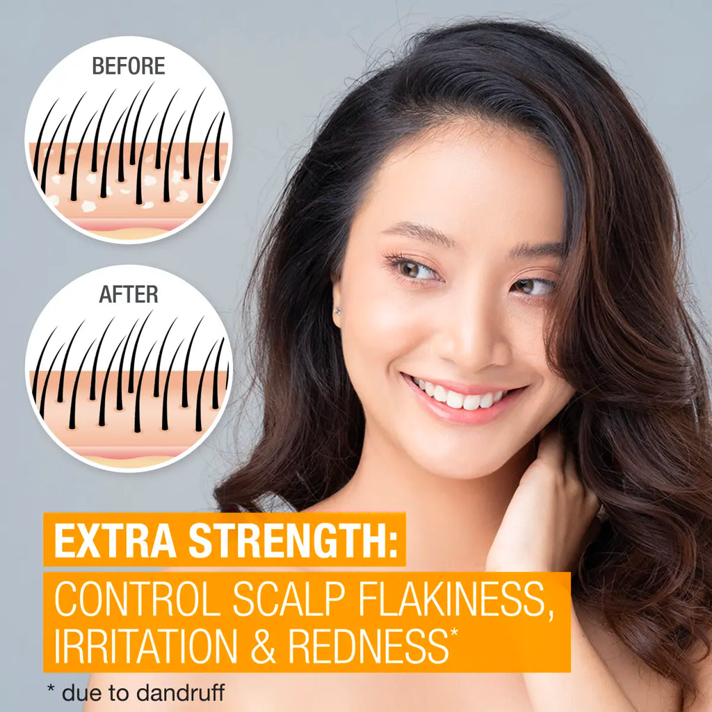 Neutrogena Scalp Therapy Anti-dandruff | Medicated Shampoo | Extra Strength