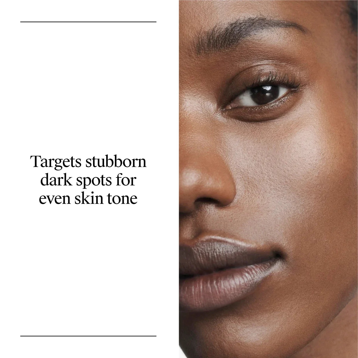 Dark Spot Corrector | Retinol + Vitamin C | Neutrogena Rapid Tone Repair | 1 Oz