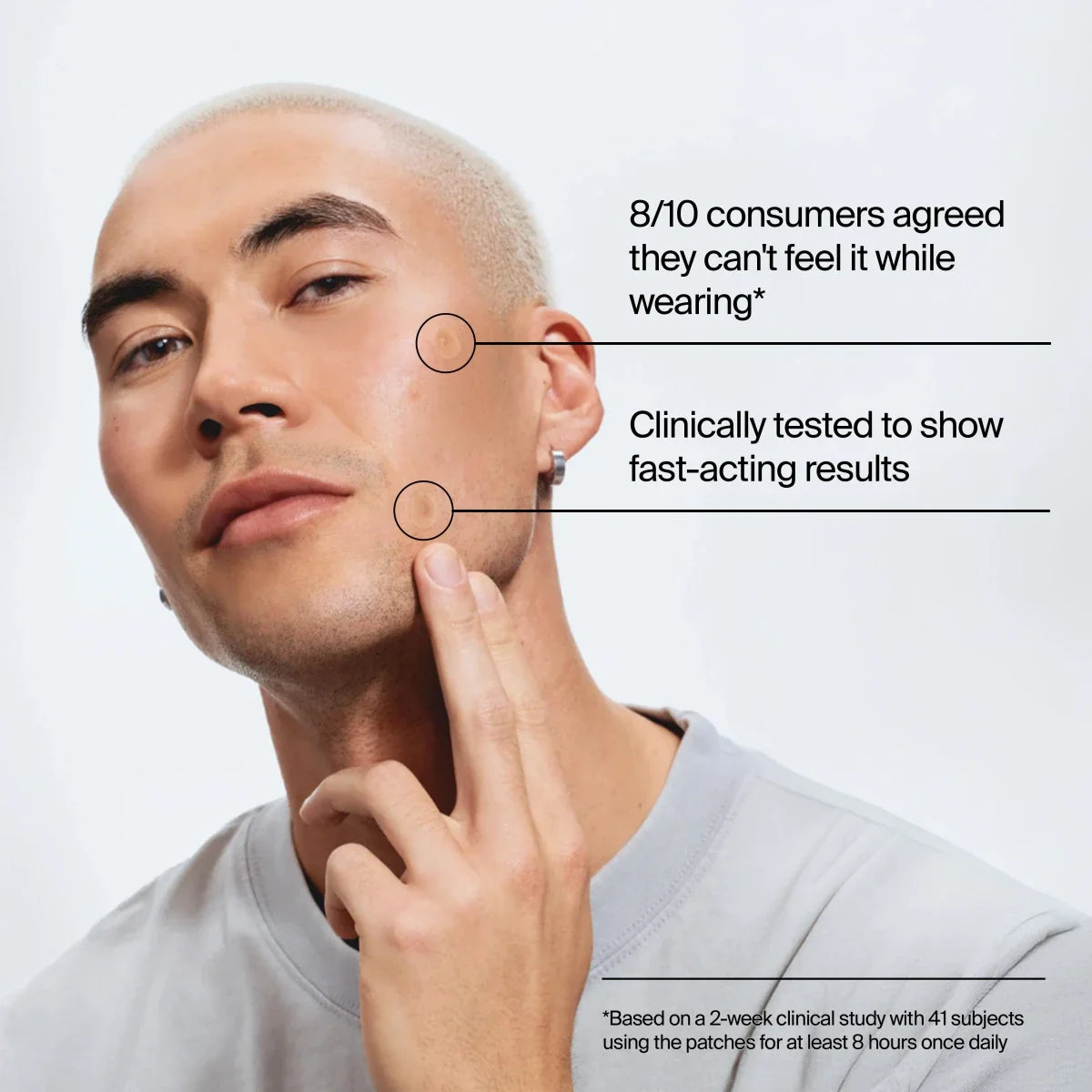 Neutrogena Stubborn Acne Ultra-Thin | 24 Patches | Combination Pack