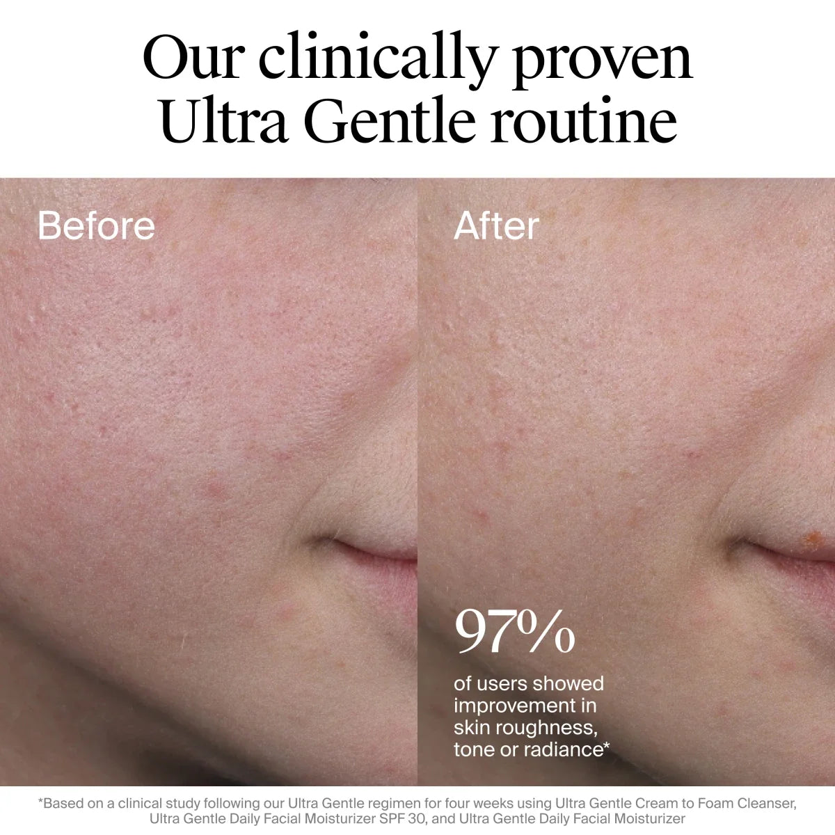 Neutrogena Ultra Gentle Daily | Lightweight Facial Moisturizer | Broad Spectrum SPF 30 | 3.4 Fl. Oz