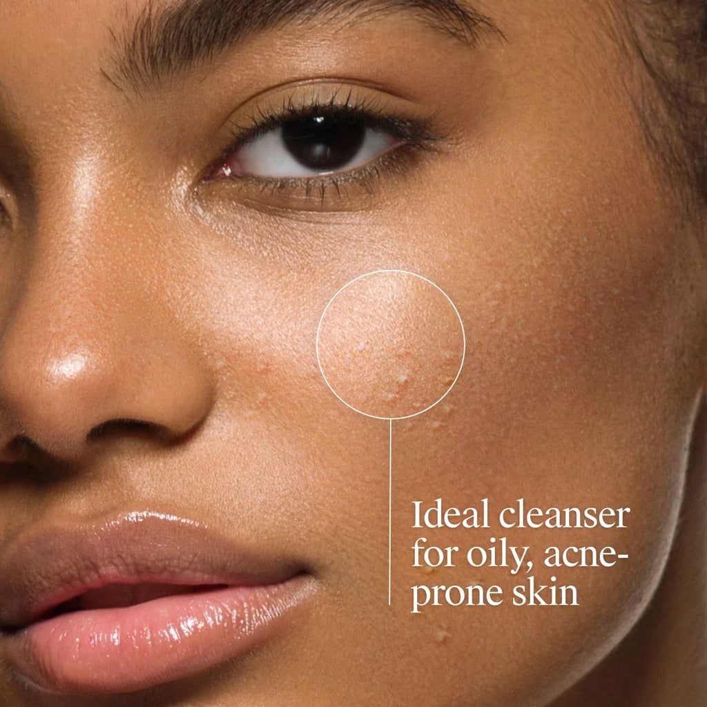 Neutrogena Oil Acne Wash | 6 Fl. Oz | Oil-Free with Salicylic Acid