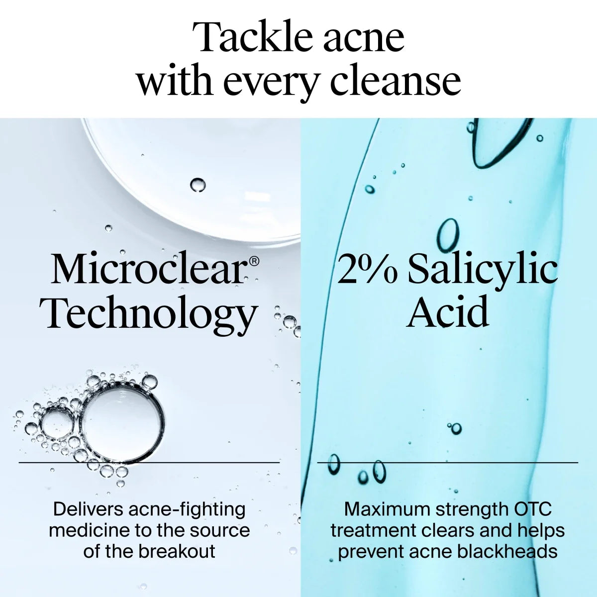 Neutrogena Oil Acne Wash | 6 Fl. Oz | Oil-Free with Salicylic Acid
