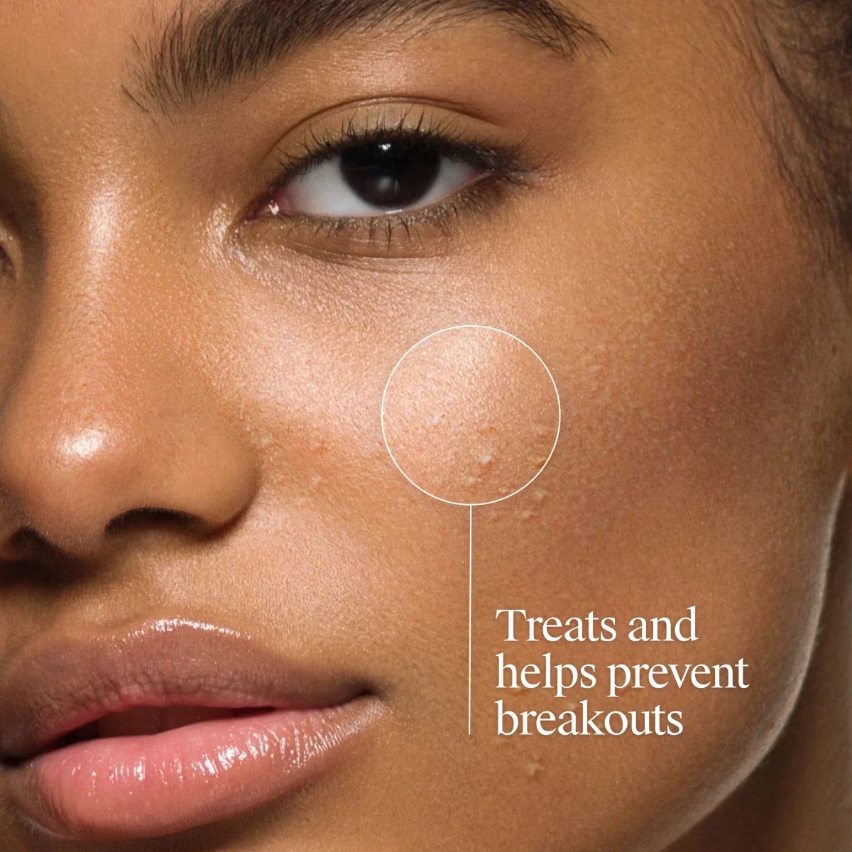 Neutrogena Oil-Free Acne Wash | Fragrance Free | 9.1 FL. Oz