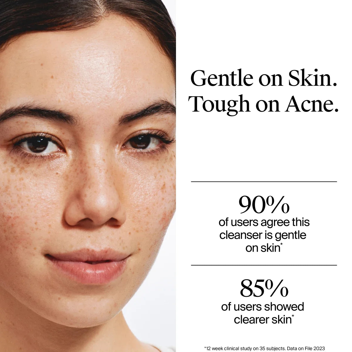 Neutrogena Oil-Free Acne Wash | 9.1 Fl. Oz | Super Size