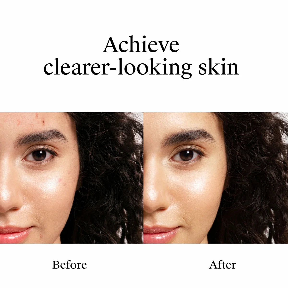 1 Oz | Neutrogena Rapid Clear Stubborn Acne Spot Gel