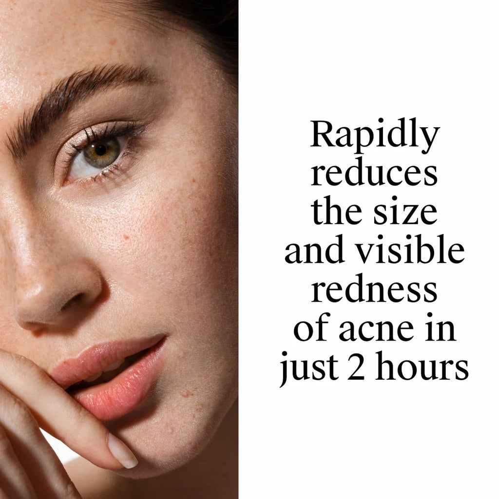 1 Oz | Neutrogena Rapid Clear Stubborn Acne Spot Gel