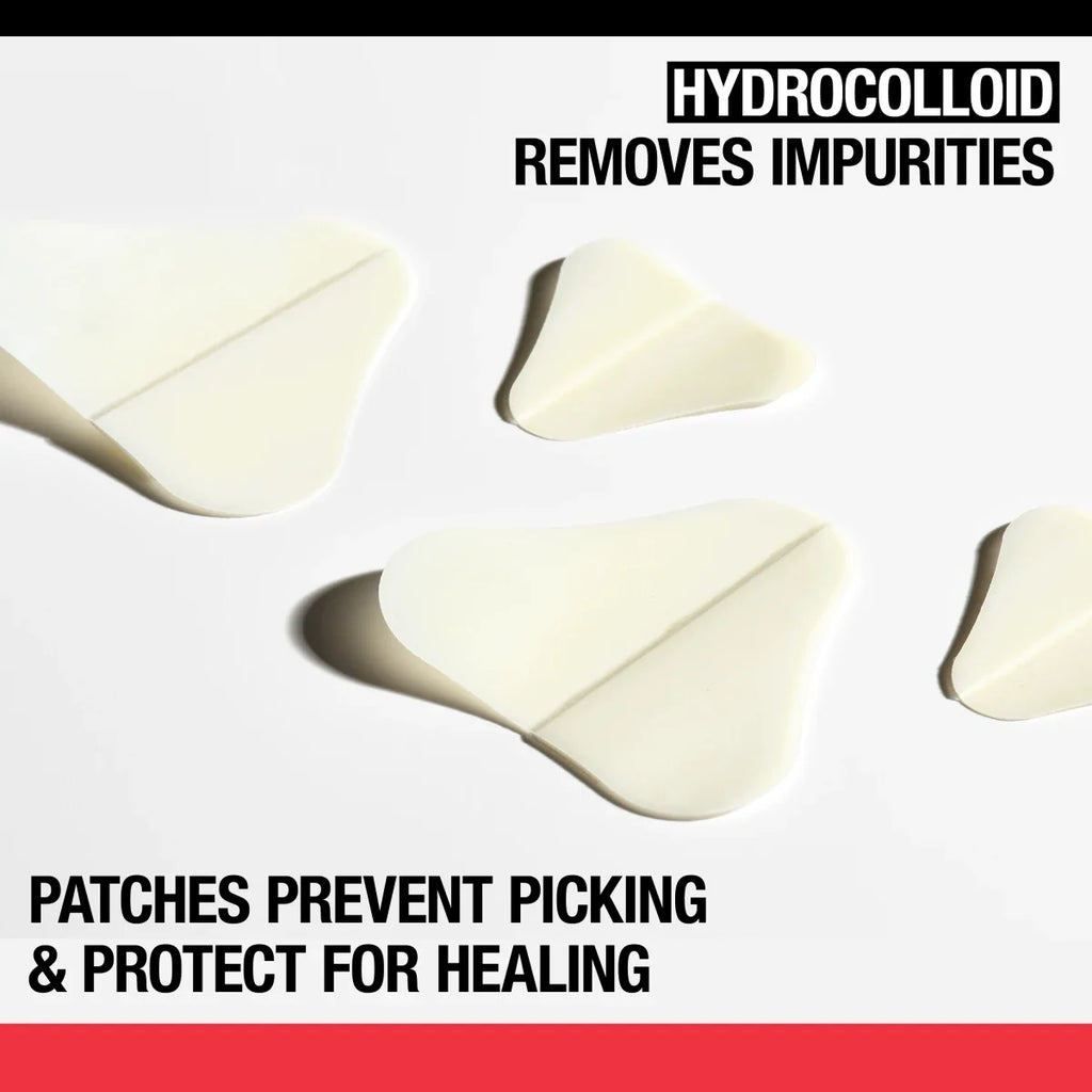 Neutrogena Stubborn Acne Ultra-Thin | Hydrocolloid Facial Patches | 10 Patches