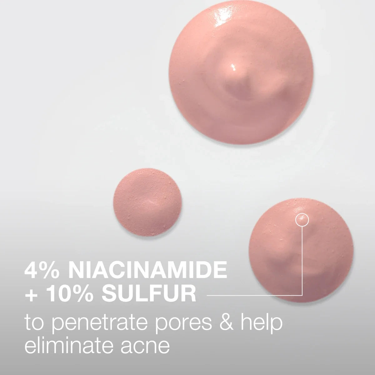 Neutrogena Stubborn Acne Spot | 1.0 Fl. Oz Drying Lotion