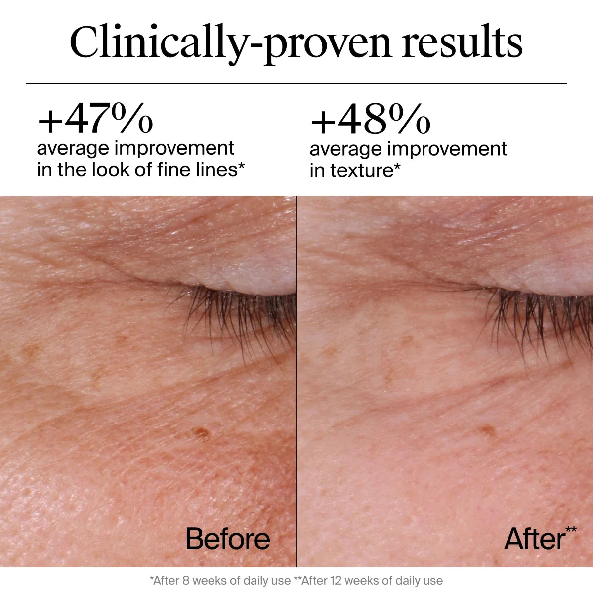 Neutrogena Rapid Wrinkle Regenerating | 1.7 Oz — Repair Cream, Regenerating Retinol + Hyaluronic Acid